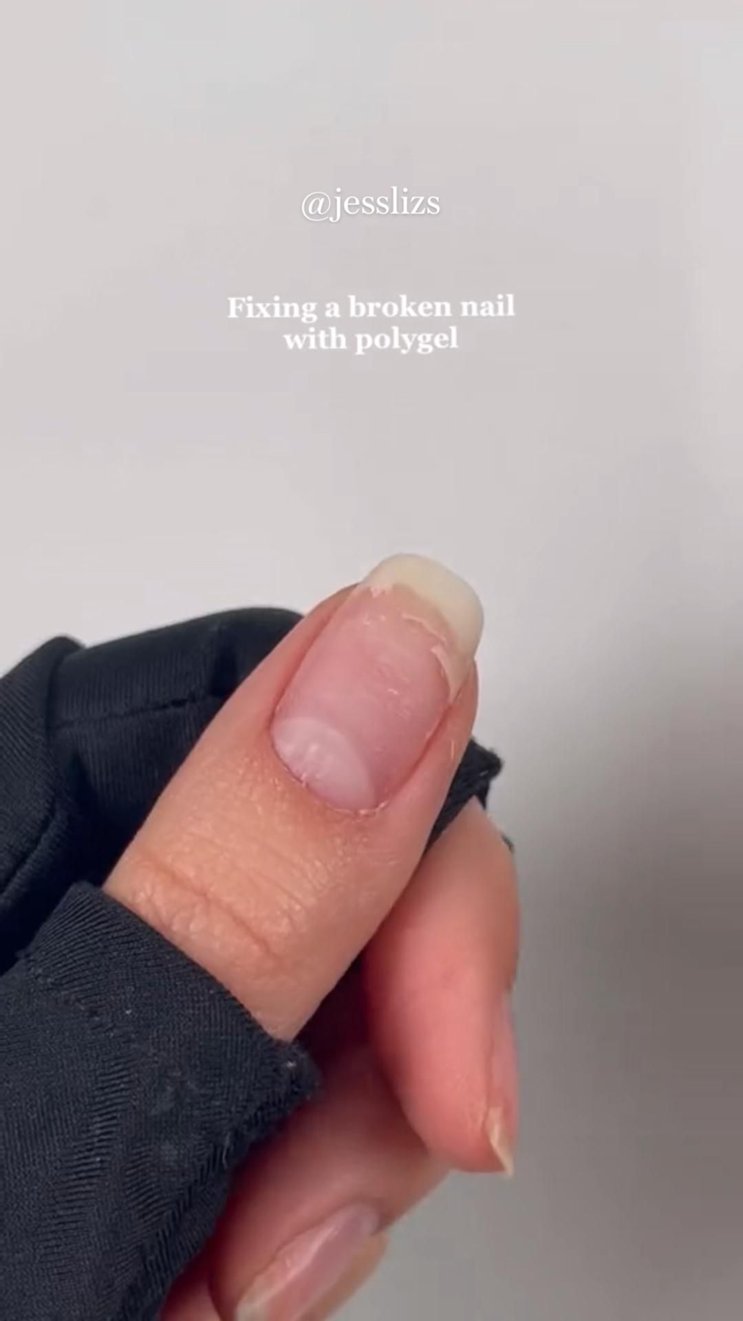 Nail fix| broken nail| diy nails| polygel nails|